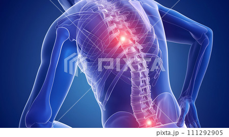 腰痛の視覚表現: ルンバー領域での痛みと不快感を具現化したイメージ<AI生成素材> 111292905