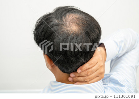 Bald in the middle head and begin no loss hair glabrous of mature Asian business smart active office man. 111301091