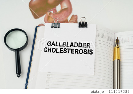 On the table there is a magnifying glass and a notepad with the inscription - gallbladder cholesterosis On the table there is a magnifying glass and a notepad with the inscription - gallbladder cholesterosis 111317385