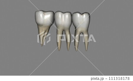 The mandibular first molar usually has two roots, a mesial and a distal The mandibular first molar usually has two roots, a mesial and a distal 111318178