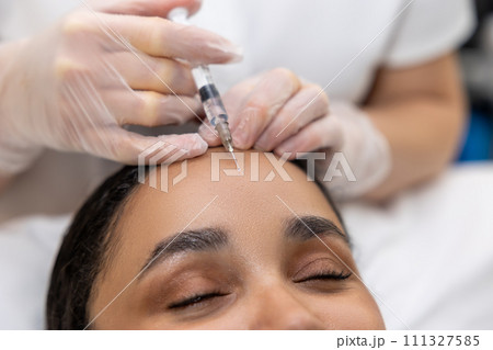 Young woman having a session of hair plasmotherapyの写真素材 [111327585] - PIXTA