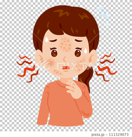 A woman with a rash on her face A woman with a rash on her face 111329073