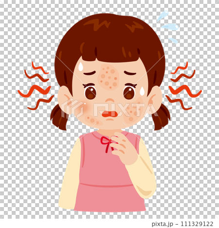 顔に発疹が出た女の子 顔に発疹が出た女の子 111329122