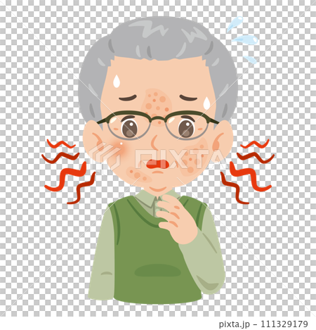 顔に発疹が出たシニア男性 111329179
