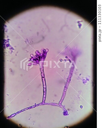 アスペルギルス属の分生子が成長しているところ アスペルギルス属の分生子が成長しているところ 111330103