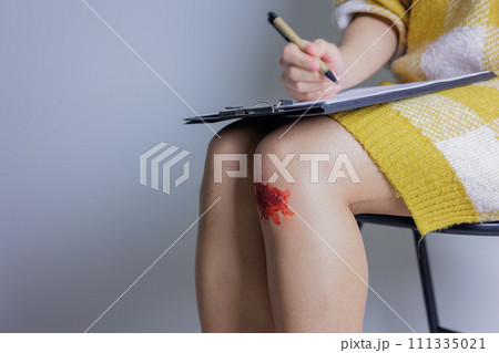 怪我したひざと、書類を記入する手元 怪我したひざと、書類を記入する手元 111335021