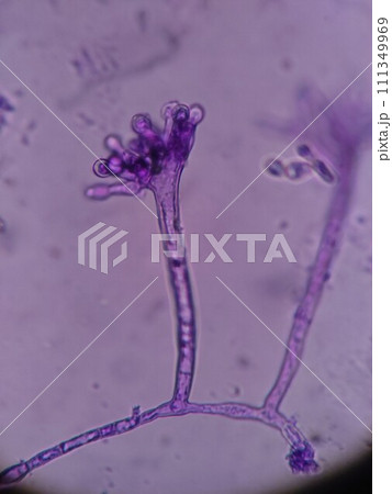 カビが成長している様子の顕微鏡写真 111349969
