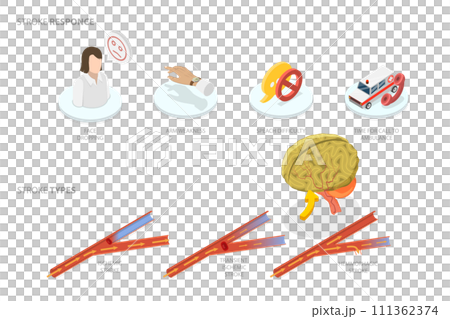 3D Isometric Flat Conceptual Illustration of Brain Blood Supply Problem, Ischemic Stroke Attack 3D Isometric Flat Conceptual Illustration of Brain Blood Supply Problem, Ischemic Stroke Attack 111362374