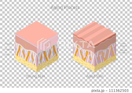 3D Isometric Flat Conceptual Illustration of Aging Process, Skin Age-related Changes 3D Isometric Flat Conceptual Illustration of Aging Process, Skin Age-related Changes 111362503