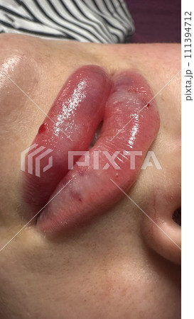 Lush, plump lips. Beautiful shape. Lush, plump lips. Beautiful shape. 111394712
