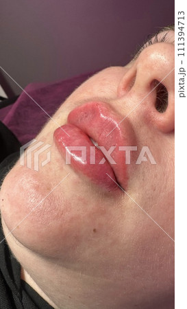 Lush, plump lips. Beautiful shape. Lush, plump lips. Beautiful shape. 111394713