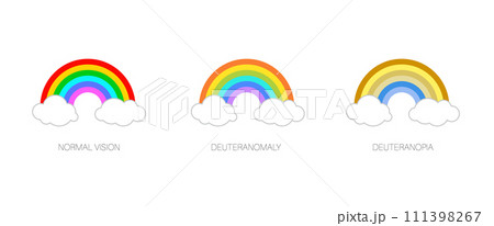 Deuteranomaly and deuteranopia 111398267
