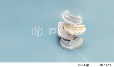 Mockup Many Die Stone, Plaster Cast Molds Of The Upper And Lower Jaws And Teeth With Pliable Imprint In Lab On Blue Background. Denture. Dental Gypsum Model, Space for Text. Prosthetics. Horizontal. 111407424