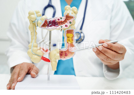 Intestine, doctor holding anatomy model for study diagnosis and treatment in hospital. Intestine, doctor holding anatomy model for study diagnosis and treatment in hospital. 111420483