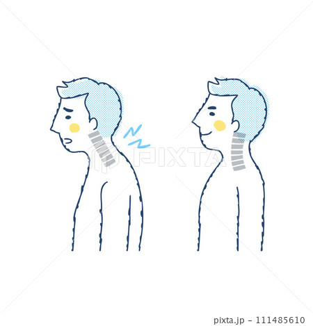 ストレートネックと正常な頚椎の比較　男性 111485610