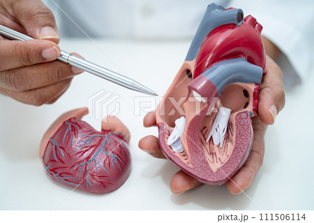 Cardiovascular disease CVD, Asian doctor holding human anatomy model for learn and treat heart disease. Cardiovascular disease CVD, Asian doctor holding human anatomy model for learn and treat heart disease. 111506114