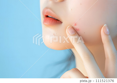 ニキビを気にするアジア人女性のクローズアップ写真 111521376