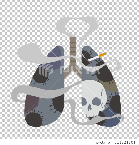タバコと汚れた肺のイメージイラスト 111521501