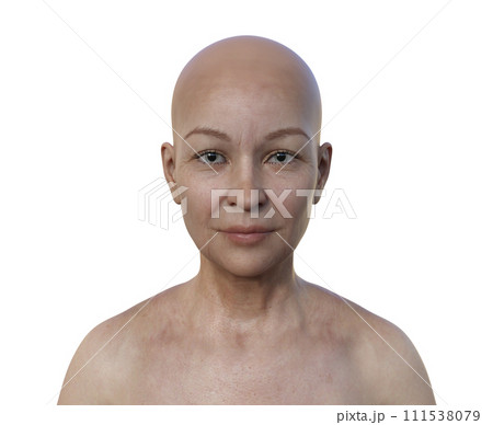 A woman with dilated eye pupils, illustration A woman with dilated eye pupils, illustration 111538079