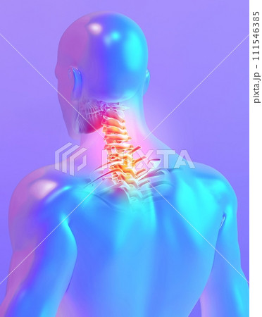 Neck painful skeleton x-ray, 3D illustration. Neck painful skeleton x-ray, 3D illustration. 111546385