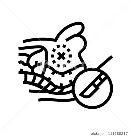 prostatectomy surgery hospital line icon vector illustration prostatectomy surgery hospital line icon vector illustration 111580217