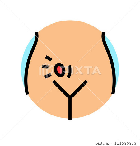 inguinal herniorrhaphy surgery color icon vector illustration 111580835