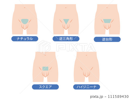 男性のVライン脱毛のデザイン 111589430