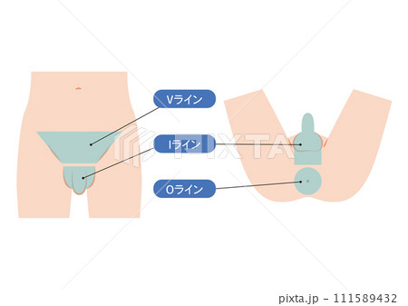 男性のVIOの脱毛箇所 男性のVIOの脱毛箇所 111589432