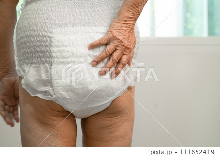 Asian senior woman patient wearing incontinence diaper in hospital, healthy strong medical concept. Asian senior woman patient wearing incontinence diaper in hospital, healthy strong medical concept. 111652419