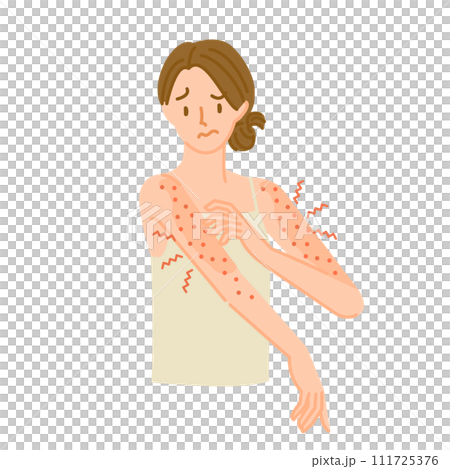 A woman whose arm skin is rough, inflamed, and itchy due to an allergic reaction. 111725376