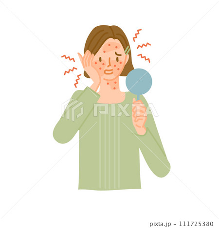 アレルギー反応で顔の皮膚が肌荒れで炎症してかゆい女性(花粉症皮膚炎) アレルギー反応で顔の皮膚が肌荒れで炎症してかゆい女性(花粉症皮膚炎) 111725380