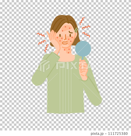 アレルギー反応で顔の皮膚が肌荒れで炎症してかゆい女性(花粉症皮膚炎) アレルギー反応で顔の皮膚が肌荒れで炎症してかゆい女性(花粉症皮膚炎) 111725380