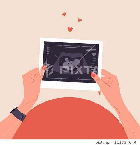 Ultrasound of baby. Female hands holding fetus silhouette photo. Embryo in womb. Pregnancy belly top view. Baby health diagnostic. Sonography or ultrasonography concept. Cartoon vector illustration 111734644