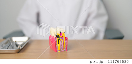 Dentist with tooth Anatomy model. Oral Teeth decay and disease, Scrape off tartar. March Oral health, Dentist Day, False Teeth. Toothache and Children Dental Health Month and Orthodontic Health Day Dentist with tooth Anatomy model. Oral Teeth decay and disease, Scrape off tartar. March Oral health, Dentist Day, False Teeth. Toothache and Children Dental Health Month and Orthodontic Health Day 111762686