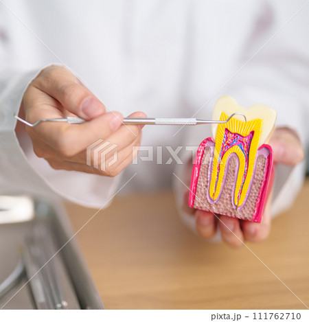 Dentist with tooth Anatomy model. Oral Teeth decay and disease, Scrape off tartar. March Oral health, Dentist Day, False Teeth. Toothache and Children Dental Health Month and Orthodontic Health Day 111762710