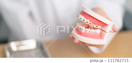 Dentist with Orthodontic tooth model and bracket or brace. Clean and Scrape off tartar. May Orthodontic Health Day, March Oral health, Dentist Day, False Teeth. Toothache and Children Dental Health Dentist with Orthodontic tooth model and bracket or brace. Clean and Scrape off tartar. May Orthodontic Health Day, March Oral health, Dentist Day, False Teeth. Toothache and Children Dental Health 111762715