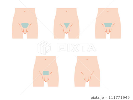 男性のVライン脱毛のデザイン 男性のVライン脱毛のデザイン 111771949