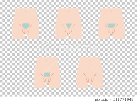 男性のVライン脱毛のデザイン 男性のVライン脱毛のデザイン 111771949