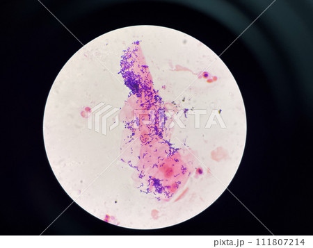 Gram positive bacilli Gram positive bacilli 111807214