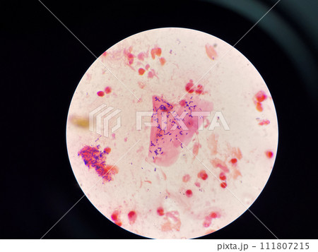 Gram positive bacilli Gram positive bacilli 111807215
