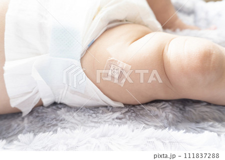 予防接種をした後の赤ちゃんの右足の付け根　イメージ 111837288