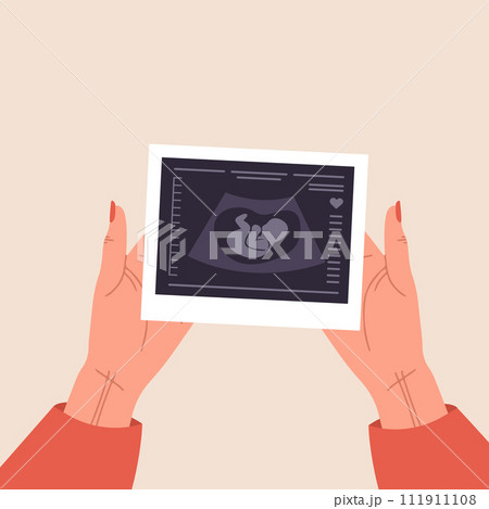 Ultrasound of baby. Female hands holding fetus silhouette photo. Embryo in womb. Pregnancy screening. Baby health diagnostic. Sonography or ultrasonography concept. Cartoon vector illustration 111911108