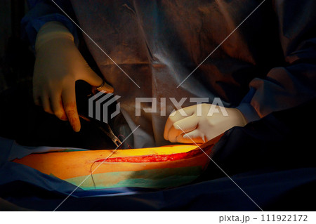 In operating room, doctors stitch up leg after it has been injured In operating room, doctors stitch up leg after it has been injured 111922172