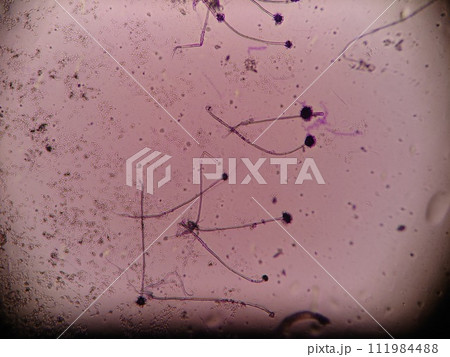 カビの胞子の顕微鏡写真 111984488
