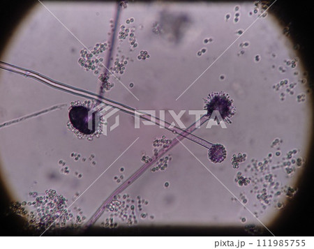 かわいいカビの胞子 111985755