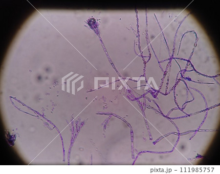 細かい菌糸が伸びる様子 111985757