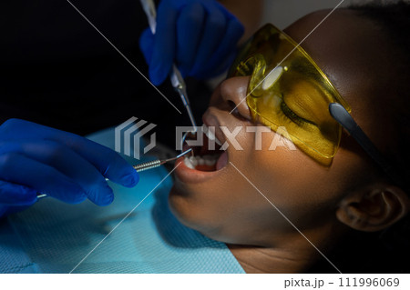 Multicultural female patient opens mouth while sitting in dentist chair in clinic 111996069