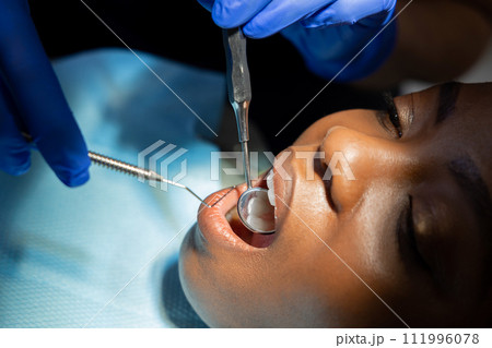 Dentist checking teeth of multicultural patient woman in medical center 111996078