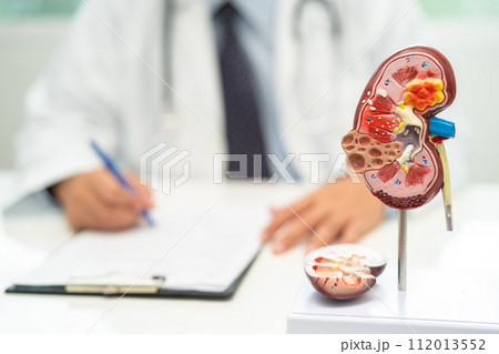 Kidney disease, Chronic kidney disease ckd, Doctor with human model to study and treat in hospital. Kidney disease, Chronic kidney disease ckd, Doctor with human model to study and treat in hospital. 112013552