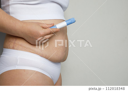 Female hand showing self injection pen near her stomach. Medicine and treatment concept Female hand showing self injection pen near her stomach. Medicine and treatment concept 112018348